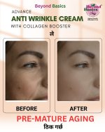 Beyond Basics Advance Anti Wrinkle Cream Price in Nepal